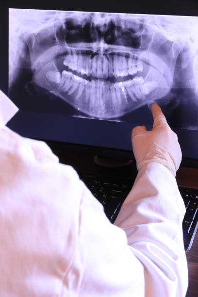 Best Emergency Wisdom Teeth Removal in South River, NM