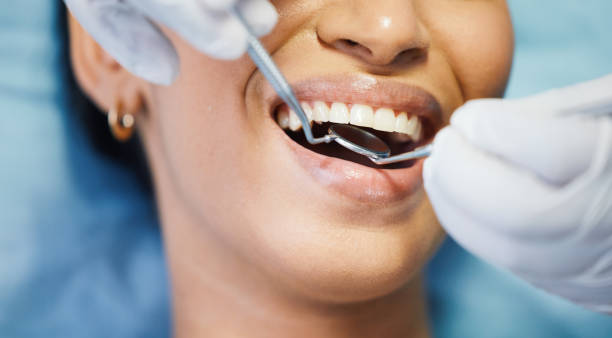 Best Emergency Tooth Extraction in South River, NM